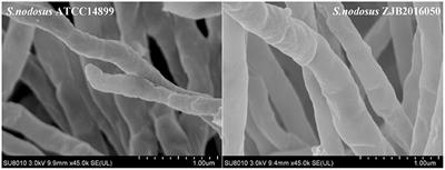 Comparative Transcriptome Analysis of Streptomyces nodosus Mutant With a High-Yield Amphotericin B